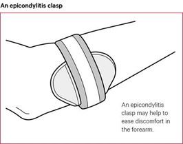 Splints for Tennis Elbow